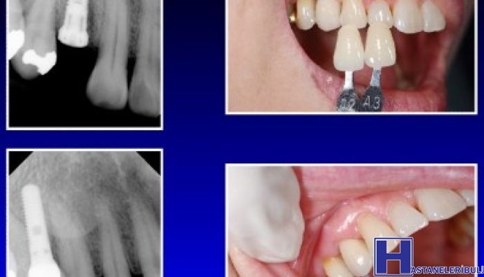 Özel Dentim Ağız Diş Sağlık Ve İmplantoloji Polikliniği